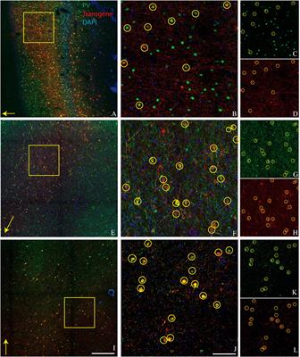 Preferential transduction of parvalbumin-expressing cortical neurons by AAV-mDLX5/6 vectors